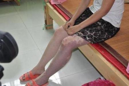 据脖子上胎记算命，有什么说法