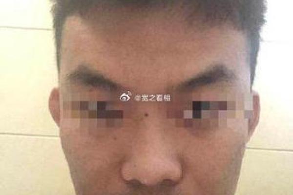 眉头有八字印预示什么？如何化解眉头八字印带来的影响？