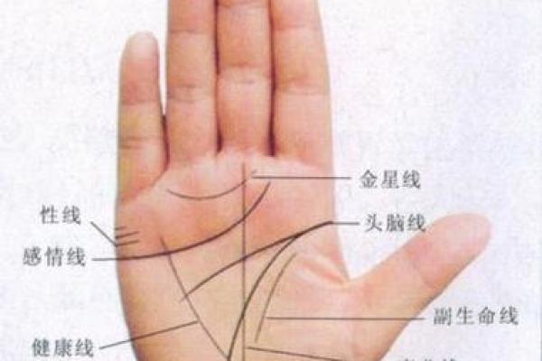 胎记算命讲解