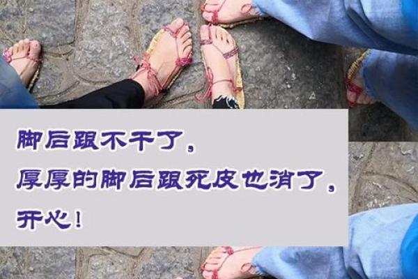 八字火炎土燥不得善终 必无子 怎样缓解