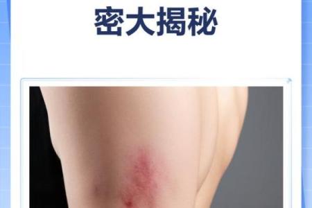 看胎记位置算命