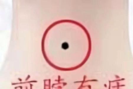 脖子上不同位置胎记算命
